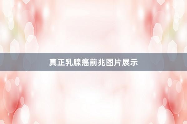 真正乳腺癌前兆图片展示